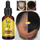 Fast Growing Hair, Essential Oils, Prevent Hair Loss Oil Scalp Treatment For Men Women